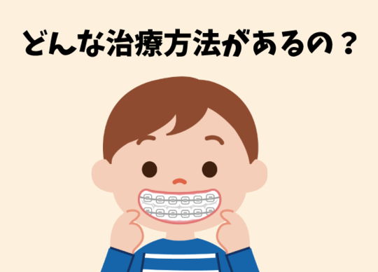 ソフトドロップ矯正法 治療期間への配慮 | 尾崎矯正歯科クリニック